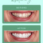 Teeth Whitening Powder